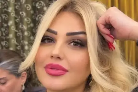 Bakıda diş çəkdirən qadın Leyla Əhmədova vəfat edib