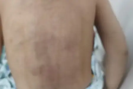 Lənkəranda 3 yaşlı uşaq zorakılığa məruz qalıb