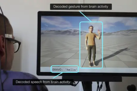 ABŞ-də iflic xəstələr üçün nitq-hərəkət sistemi yaradıldı